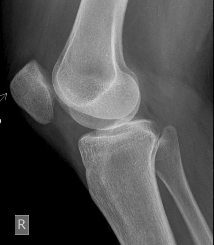 Artroscopia de rodilla, hombro y tobillo Artroscopia de rodilla, hombro y tobillo